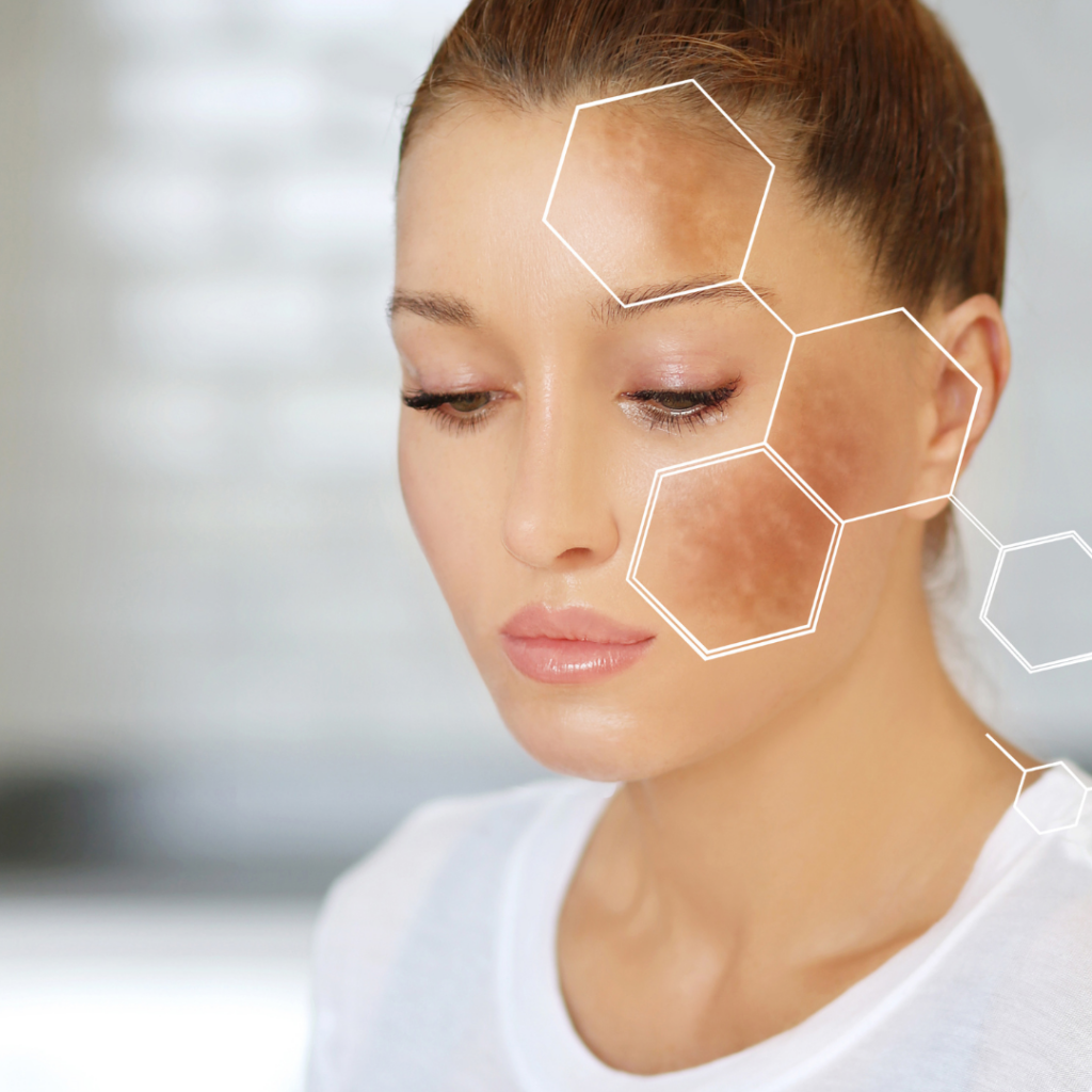 tipos de manchas en la piel