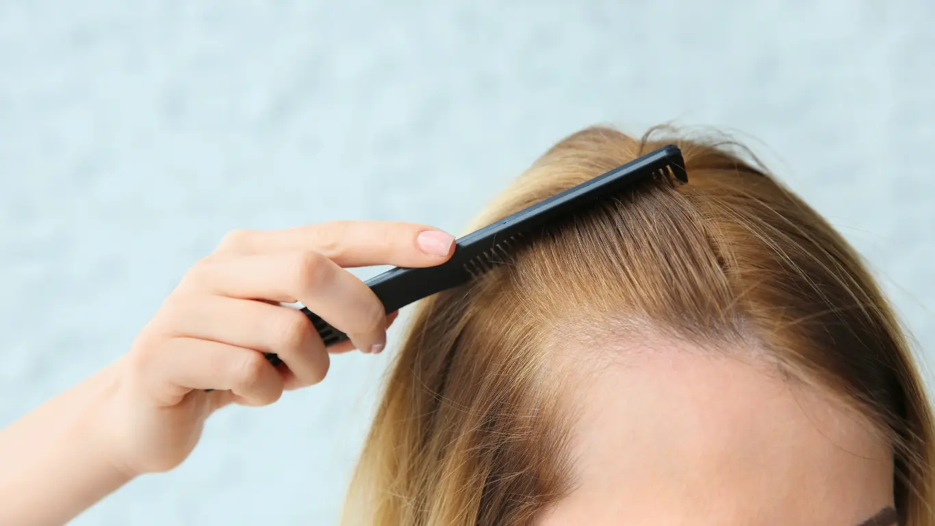 el tratamiento de la alopecia androgénica